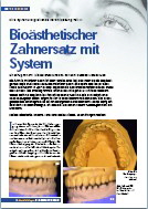 Bioaesthetischer Zahnersatz Teil 1